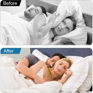 2IN1 Anti Snoring Device, New Custom Snoring Solution For Better Sleep