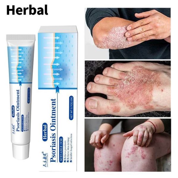 Antibacterial Psoriasis Cream Itch Eczema Relief Skin Rash