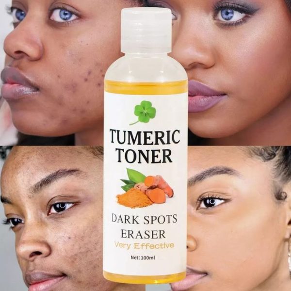 Dark Spot Corrector Tumeric Serum Blackhead Pimple Remover