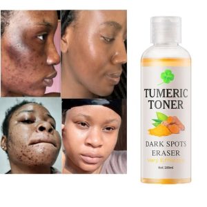 Dark Spots Corrector Melasma Remover Tumeric Serum Acne Remover